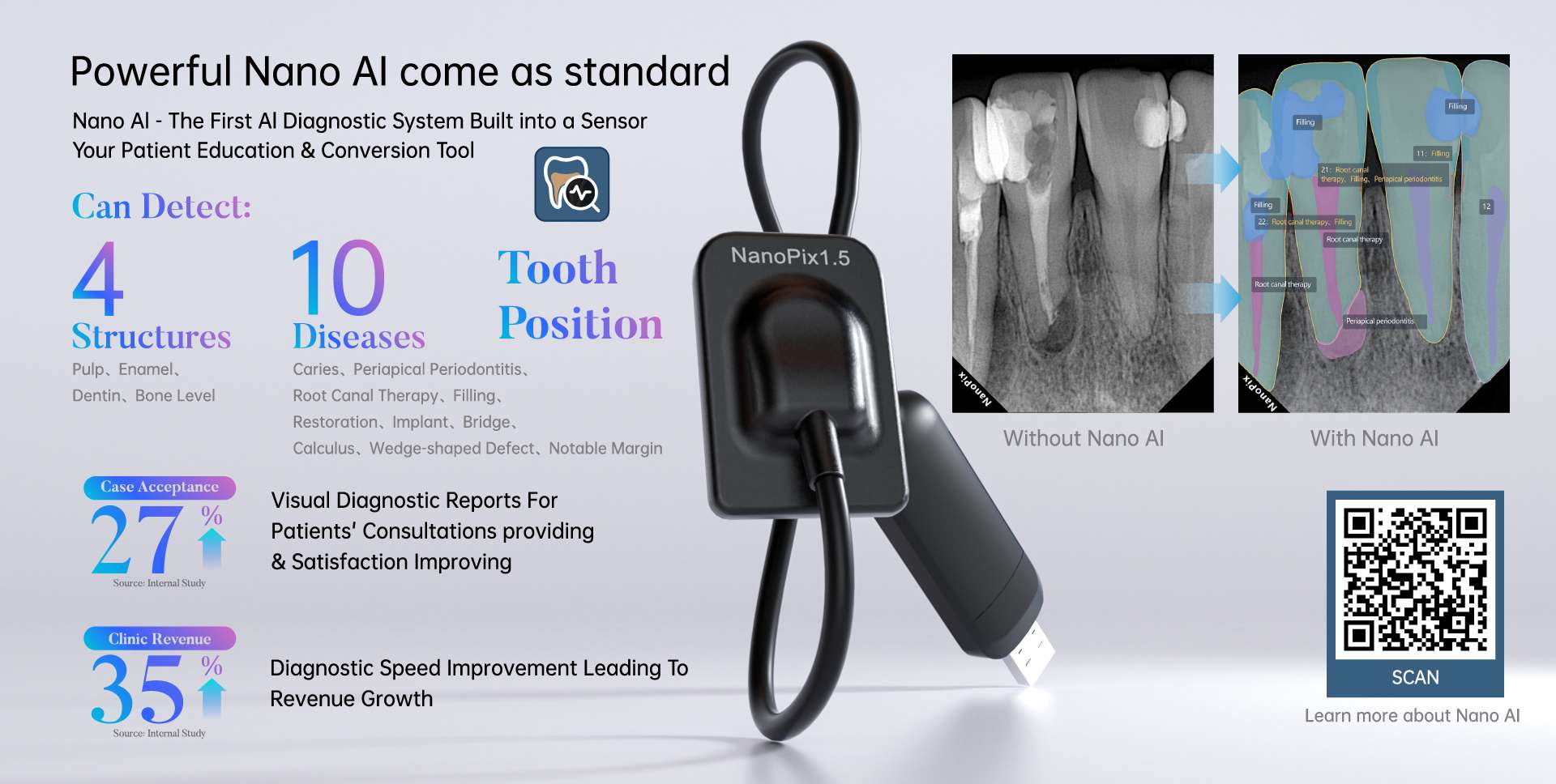 NanoPix 1.5 - Digital Sensor - Changzhou Sifary Medical Technology Co.,Ltd.