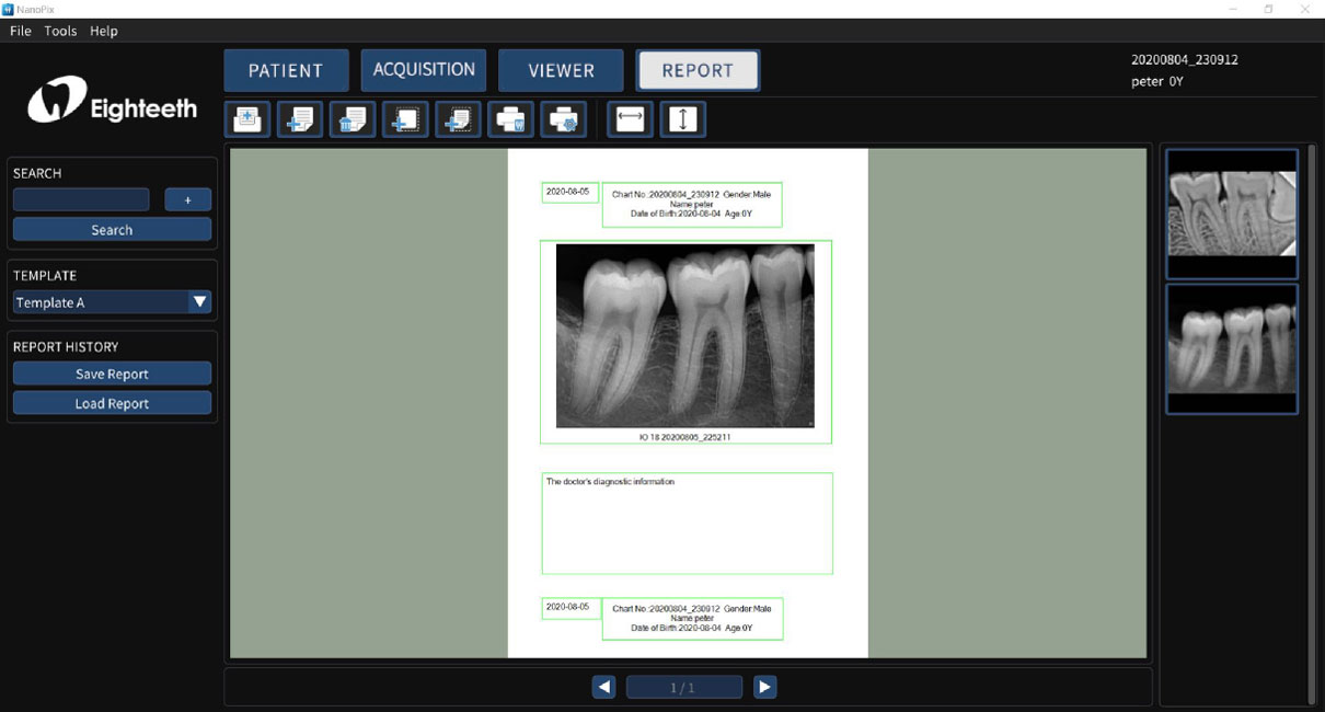 Step 4. Generate 'Report'