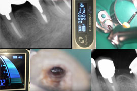 I thought this motor was a copy of TriAuto ZX2. But it is not at all...