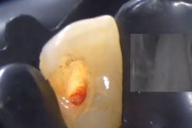 The reason why It’s good to work with E connect S, an Endo motor with...