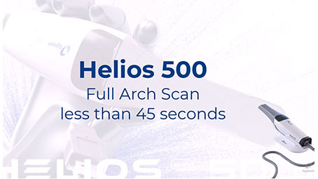 Helios 500: All-around Intraoral Scanner for Dentists