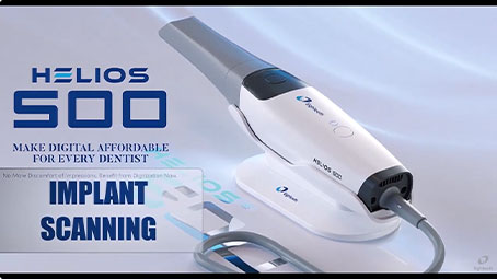 Helios 500 Implant Workflow
