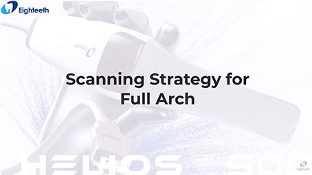Helios 500 Scanning Strategy for Full Arch