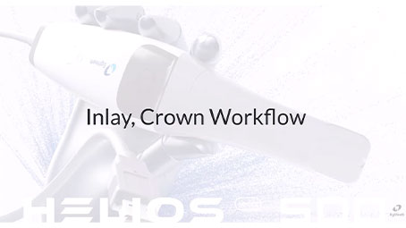 Helios 500 Inlay&Crown Workflow