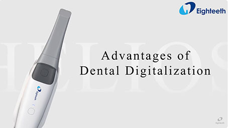 Advantages of Dental Digitalization