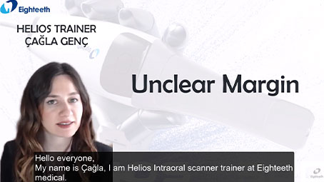 Helios 500 Scanning Strategy for Unclear Margin Case