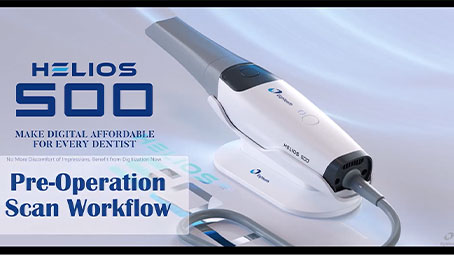 Helios 500 Pre Operation Scan Workflow