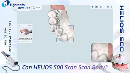 Can Helios 500 Scan Scan Body