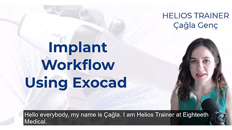 Helios 500 Implant Workflow in Exocad