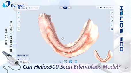 Can Helios500 Scan Edentulous Model