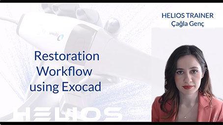 Helios 500 Restoration Workflow in Exocad