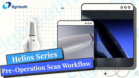 Helios Series | Pre-Operation Scan Workflow