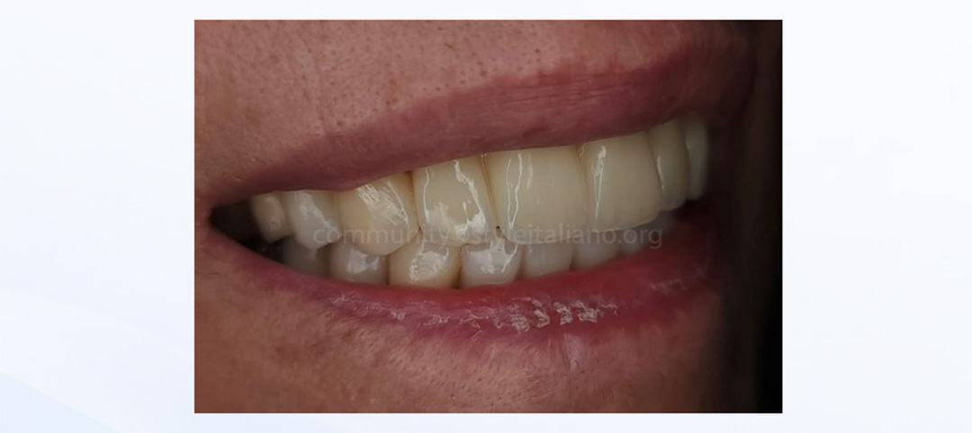 EN18期casebook-16_2