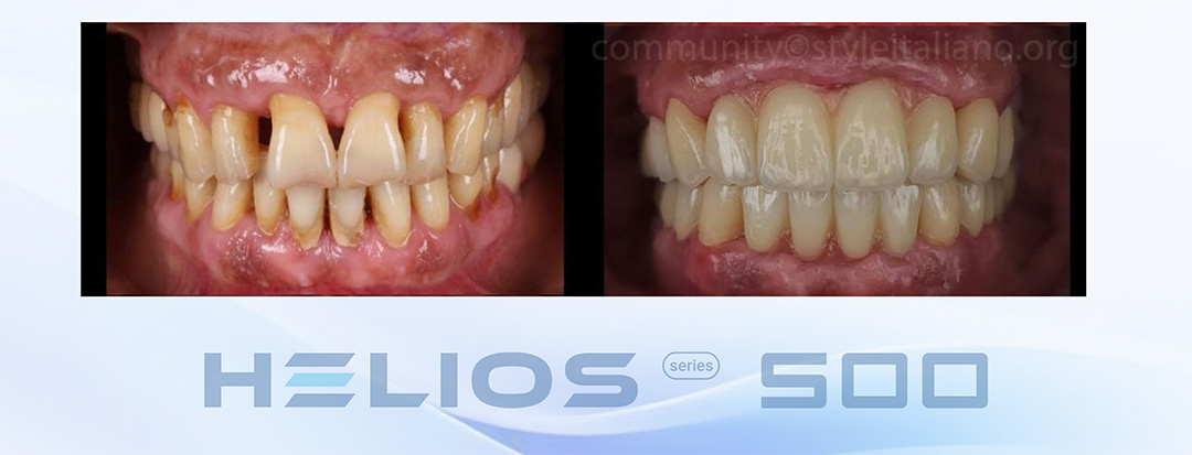 EN18期casebook-17_1