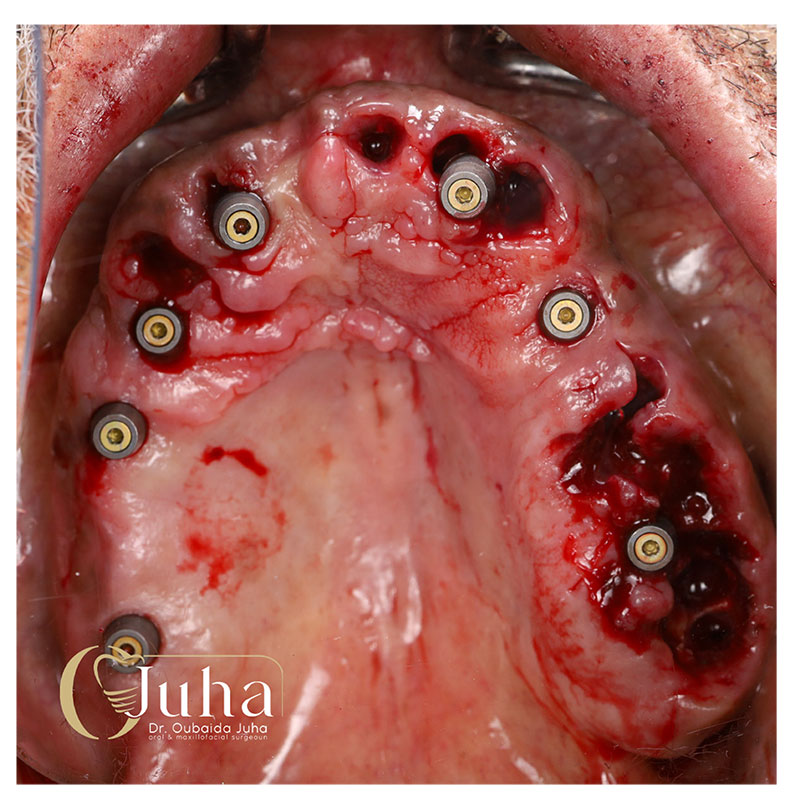 Eighteeth-Digital-Casebook-5-1