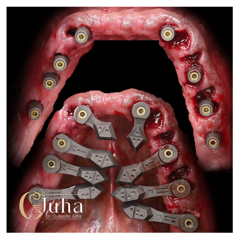 Eighteeth-Digital-Casebook-6-1